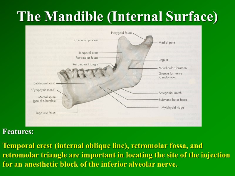 The Mandible (Internal Surface)   Features: Temporal crest (internal oblique line), retromolar fossa,